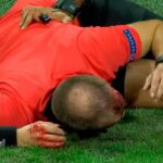 hakimin başı yarıldı