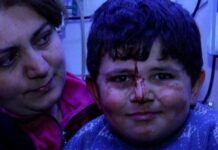 Erməni terrorunun canlı şahidi 6 yaşlı Bəxtiyar: Evimizə bomba düşəndə qorxmadım, heç kişi də qorxar? Erməni terroru