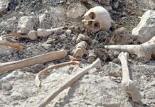 Fərrux yüksəkliyində tapılmış meyit qalıqlarının ekspertizası onların azərbaycanlılara aid olduğunu sübut edir Fərrux yüksəkliyində tapılmış meyit qalıqları