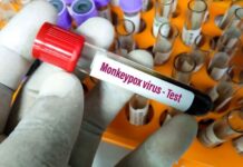 meymunçiçəyi test dəsti