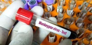 meymunçiçəyi test dəsti
